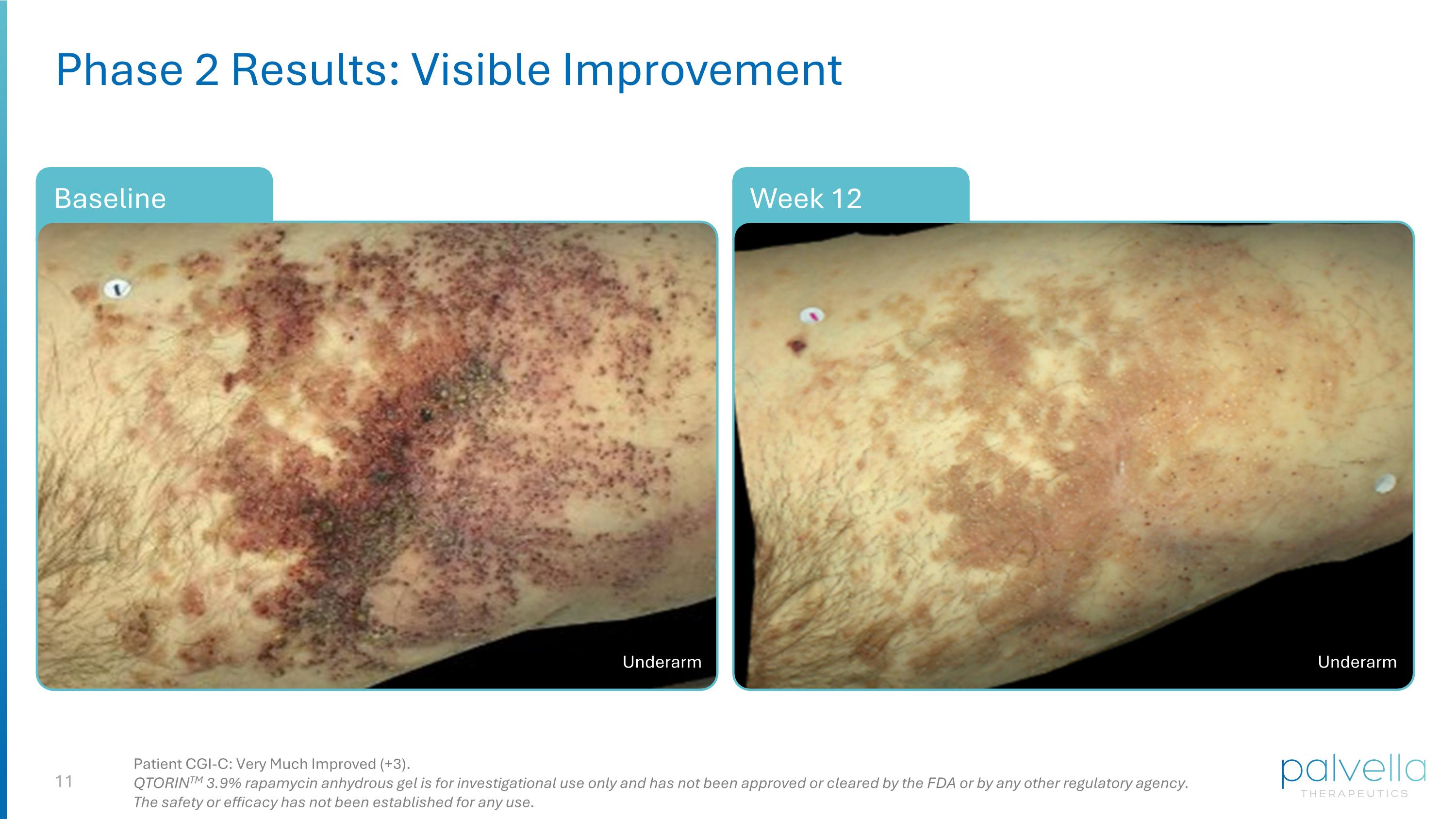 Slide 11