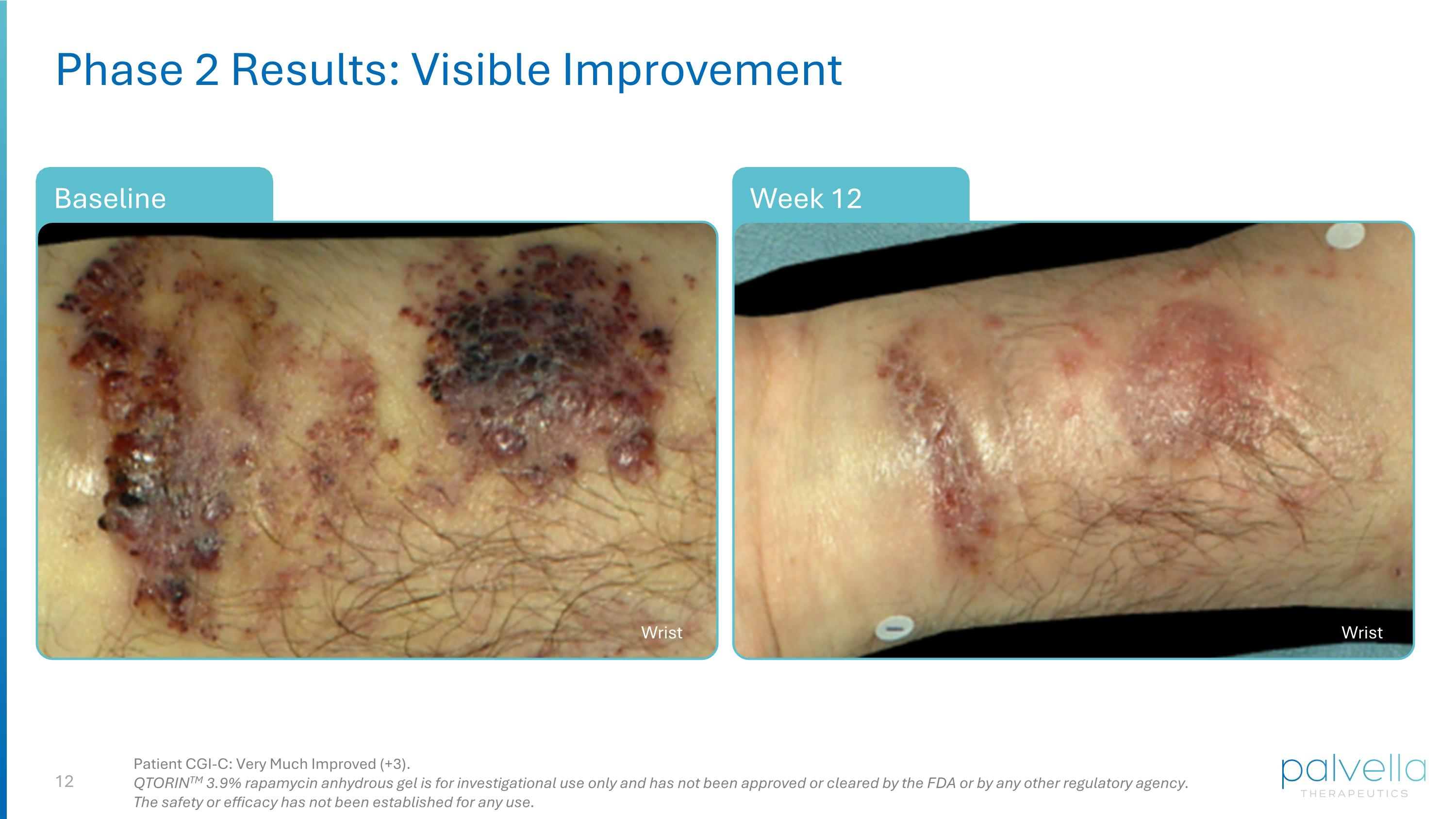 Slide 12